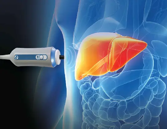 Fibroscan